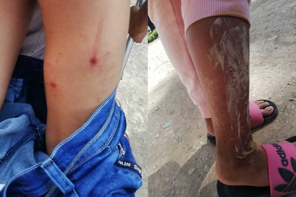 Chilca: Nuevos ataques de canes callejeros (VÍDEO)